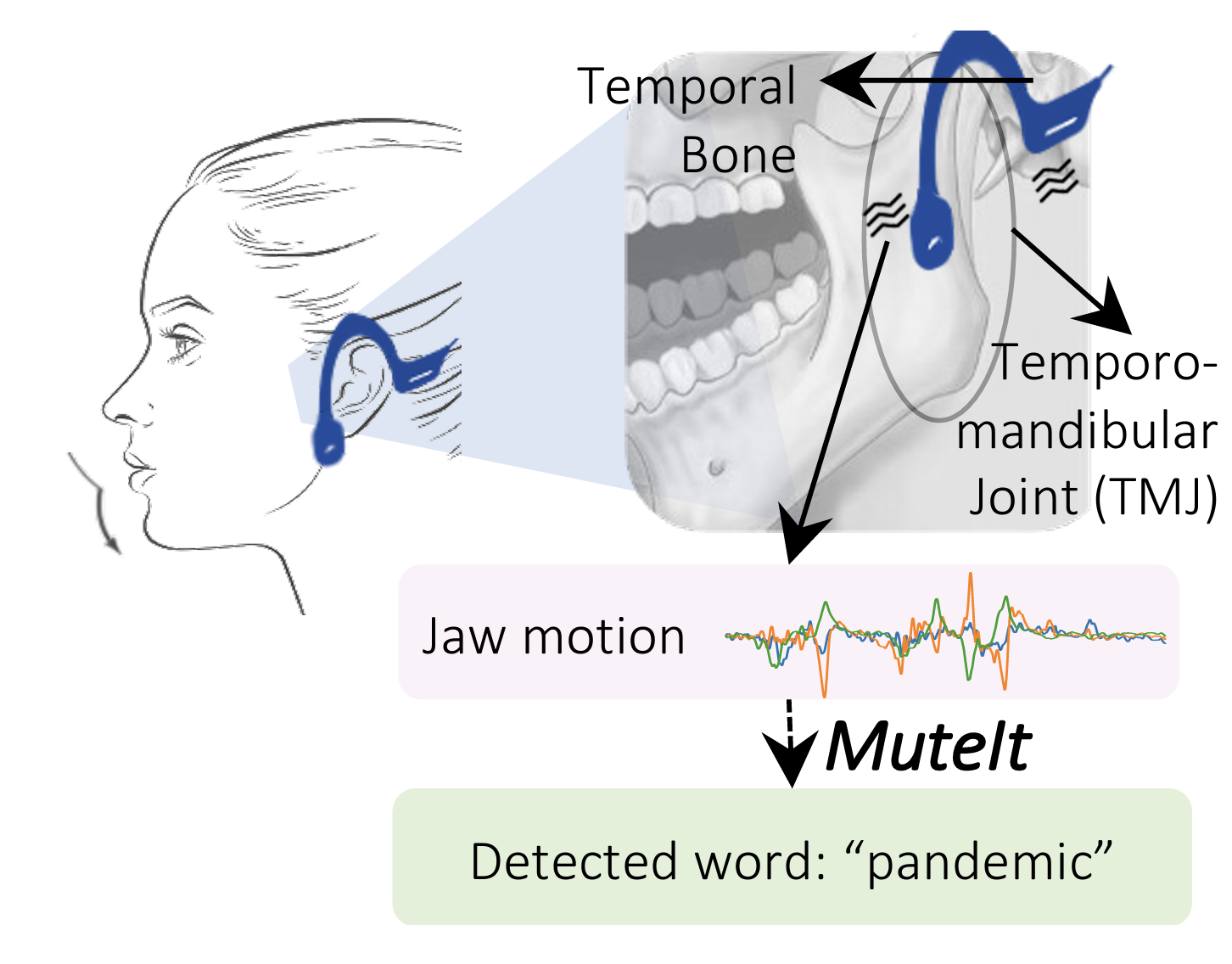 Figure 1 - A close up look at MuteIt which interprets silent speech. Figure 1 - A close up look at MuteIt which interprets silent speech.